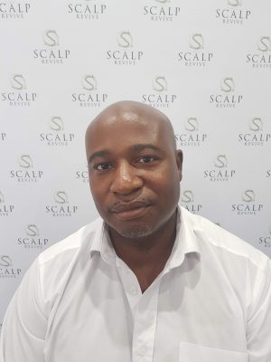 scalp micropigmentation in Leeds