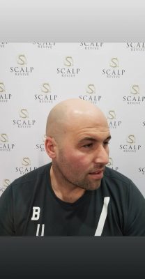 baldness