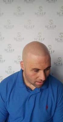 Hair Tattoo