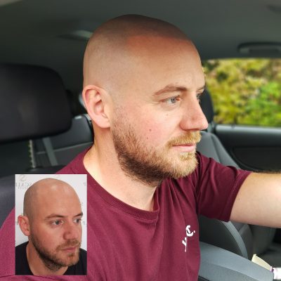 hair tattoo outside