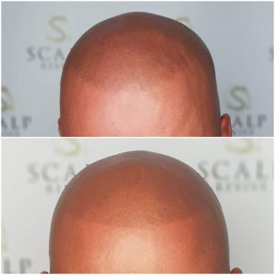 hairline styles