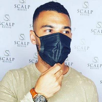 hair tattoo Leeds. scalp micropigmentation Uk. hair tattoo. scalp. hair.