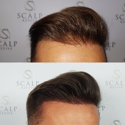 hair leeds