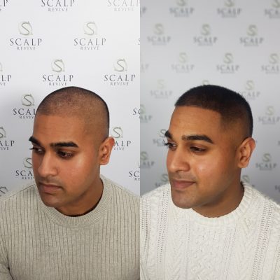 Hair Tattoo Leeds