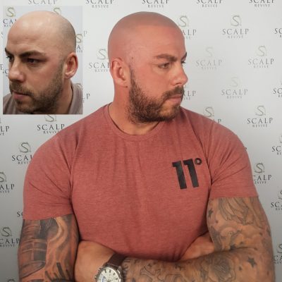 Hair Tattooing in Leeds